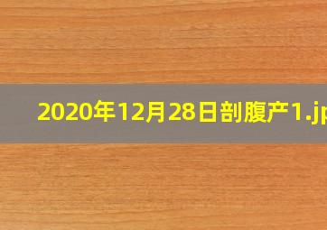 2020年12月28日剖腹产